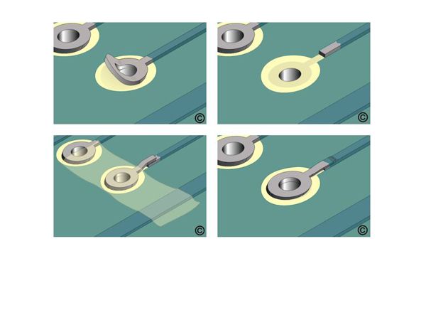 Repairs to lands and annular rings will meet the highest IPC guidelines.